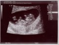 Picture 00